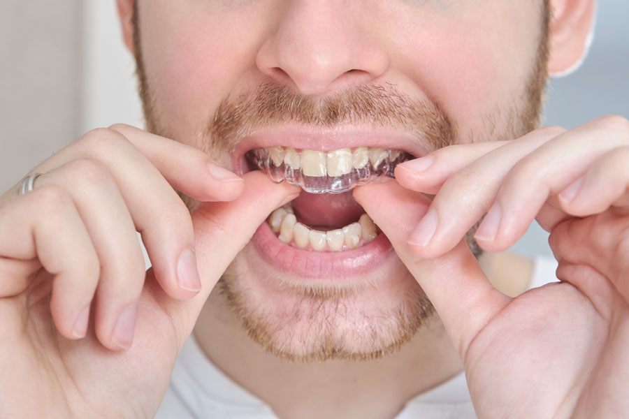 servicios04-ballesteros