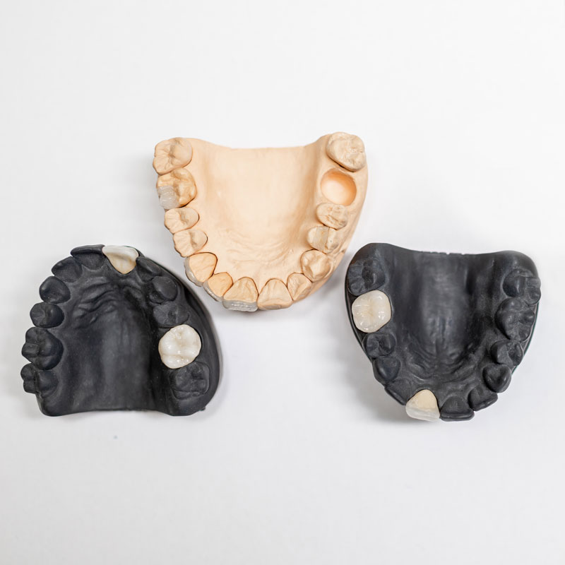 servicios05-ballesteros